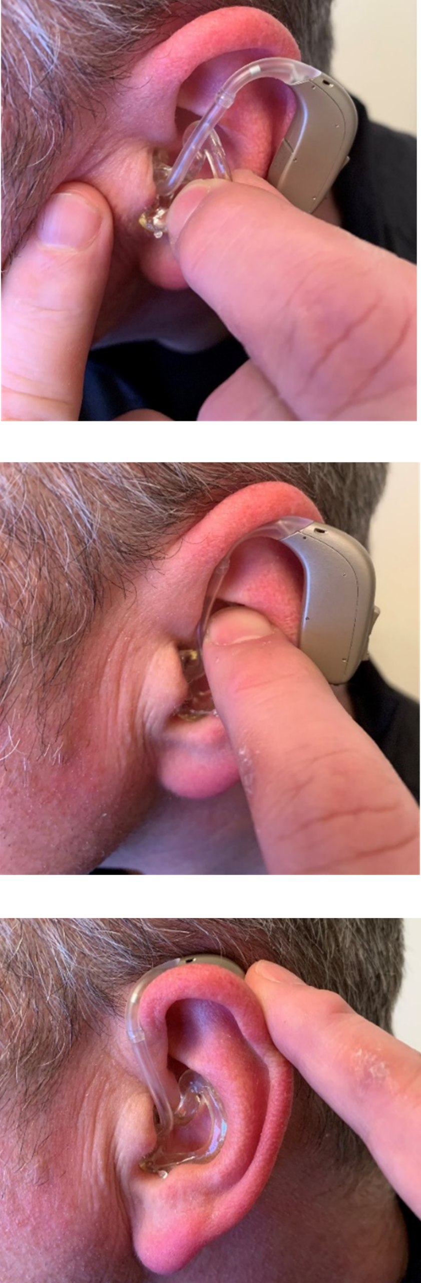 illustrated ear mould insert